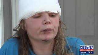 Jacksonville woman says she was hit left for dead [upl. by Grieve843]