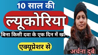 ल्यूकोरिया से एक दिन में छुटकारा how to get relief from leucorrhoea [upl. by Oruhtra]