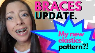 BRACES UPDATE  MY NEW ELASTICS PATTERN  HOW TO PUT ON ELASTICS FOR BRACES  DONNELLE GRIFFIN [upl. by Kassi]