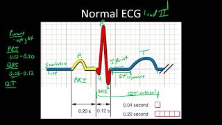 Introduction to Arrhythmias The Humble ECG [upl. by Homere443]