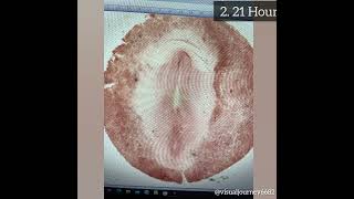 Study Of Developmental Stages Of Chick through Permanent Slides Chick Embryo Chick Egg [upl. by Nagaer]