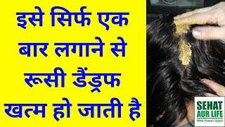 Dandruff Treatment At Home Dandruff Ko Kaise Khatam Kare In Hindi Balo Me Rusi Hatane Ka Tarika [upl. by Adorne519]