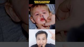 HIDUNG BAYI INI KEMASUKAN MAINAN‼️shorts alurcerita storytelling [upl. by Flavia]