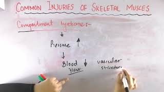 Compartment syndrome  Common injuries of skeletal muscle  Biomechanics of skeletal muscle [upl. by Seraphim847]