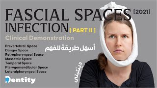 شرح مبسط  Fascial Spaces Infection  PART 22 [upl. by Ransome399]