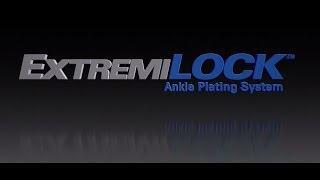 OsteoMed  ExtremiLOCK Ankle Plating System  Ankle Fracture Plating [upl. by Nekciv]