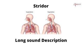 Stridor  Lung sound description  Upper airway obstruction [upl. by Beitz167]