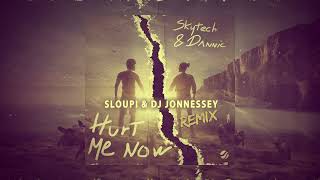 Skytech amp Dannic  Hurt Me Now  Sloupi amp DJ Jonnessey Remix  SkioMusic Remix Contest [upl. by Liagibba]