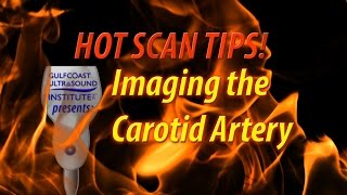 Hot Tip  Imaging The Carotid Artery [upl. by Dickey]