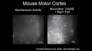 Calcium imaging in mouse motor cortex  Spontaneous Activity and Interictal Epileptiform Discharges [upl. by Sayer]