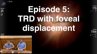 Retina Chats Episode 5 TRD with foveal displacement [upl. by Tomlinson]