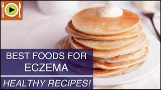 Best Foods for Eczema  Healthy Recipes [upl. by Mckenzie344]