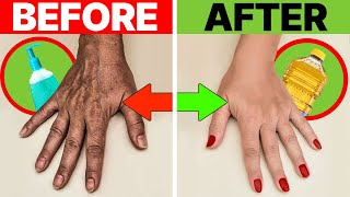 Get Rid Of WRINKLES amp Hand Dryness Transform Your Hands INSTANTLY [upl. by Asaert]