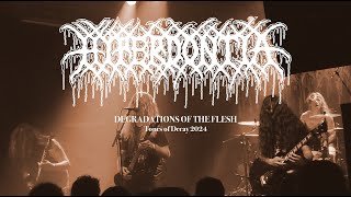 Hyperdontia  Degradations of the Flesh Live at Tones of Decay  Prague Czech Republic 2024 [upl. by Castillo]