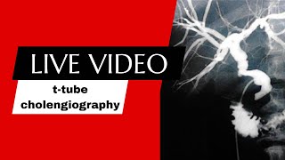 ttube cholangiography procedure radiologytechnologistamir RadiologyClasses MicroStrategyUS2023 [upl. by Lyford614]