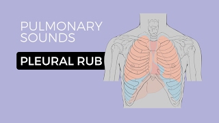 05  Lung Sounds  Pleural friction rub 🎧 [upl. by Janenna]