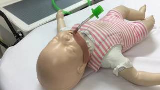 Securing the Paediatric Endotracheal Tube [upl. by Eddra]