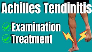 Achilles Tendinitis Treatment  San Diego Sports Therapy [upl. by Giustina]