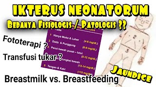 Ikterus Neonatorum Perbedaan Ikterus Fisiologis amp Patologis Breastmilk amp Breastfeeding Jaundice [upl. by Illyes949]