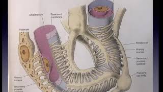 12 05 2020 Pathology Cystic Diseases of Kidney [upl. by Rebah]