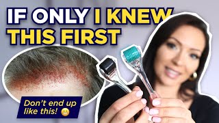 The Dermaroller Watch This BEFORE Microneedling What I wish I knew Before I Started Dermarolling [upl. by Ettenil38]