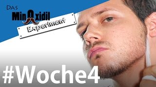 Minoxidil  Routine für den Bart  Das Minoxidil Experiment Woche4 [upl. by Htebiram]