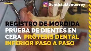 REGISTRO de MORDIDA y Prueba en Cera👅Prótesis Dental Inferior Parte2 ProtesisDentales [upl. by Drehcir]