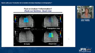 Pr Valérie VILGRAIN at JFR 2020 [upl. by Laise91]