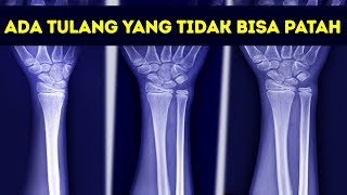 12 Kelainan Genetika ini Membuatmu Seperti Manusia Super [upl. by Lisan]