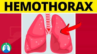 Hemothorax Medical Definition  Quick Explainer Video [upl. by Elyssa177]