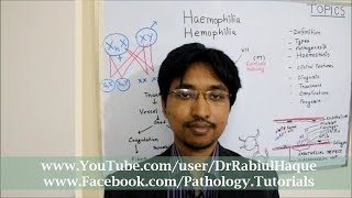 Haemophilia  Definition Types Pathogenesis Clinical Features Diagnosis Treatment  HD [upl. by Ecitnerp]