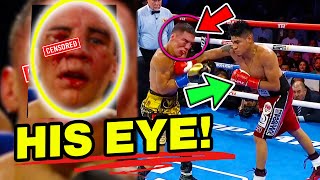 EYE NAVARRATE PUNISHES OSCAR VALDEZ EYE FULL FIGHT RECAP BY BOXINGEGO  REALEST BREAKDOWN [upl. by Rebmetpes503]