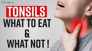 Tonsils Remedies What To Eat And What To Avoid In Tonsils  Sore Throat Treatment [upl. by Naharba]