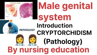 PathologyMale genital system Introductioncryptorchidism Bsc nursing [upl. by Kravits]