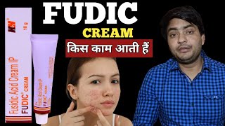 fudic cream  fudic cream review  fudic cream benefits  fudic cream ke fayde [upl. by Suryt]