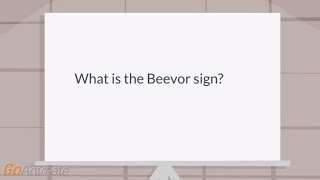 What is the Beevor sign [upl. by Erdnoed]