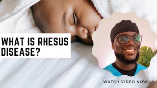 What Every woman should know about Rhesus Disease [upl. by Heimlich732]