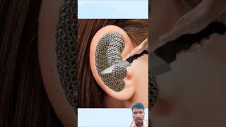 Asmr Ear Cleaning And Treatment Animation shorts asmr Animation [upl. by Erskine528]