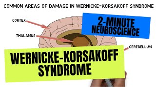 2Minute Neuroscience WernickeKorsakoff Syndrome [upl. by Elehcar]