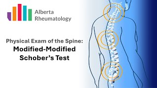 Rheumatology BACK exam Schobers Test [upl. by Nivahb]