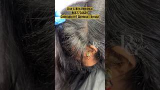 Lice damage hairhow to remove lice from hairlice and nits removallice in baby hairlice removal [upl. by Fitzger]