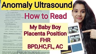 Anomaly Scan 20 weeks घर पर कैसे पड़े ।Anomaly Scan Baby Boy or Baby Girl How to Read level 2 report [upl. by Ingles]