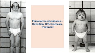 Mucopolysaccharidosis Biochemistry  Mucopolysaccharidosis [upl. by Anitahs]