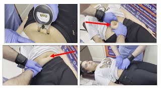 7 years old gas problem  navel displacement cured with chiropractic  chiropractic in Delhi [upl. by Ynaffi]