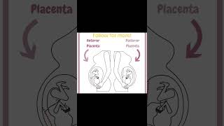 Why Your Placenta Location Matters [upl. by Emmuela]