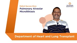 Lung Transplantation for Pulmonary Alveolar Microlithiasis  Yashoda Hospitals Hyderabad [upl. by Hgielrebmik749]