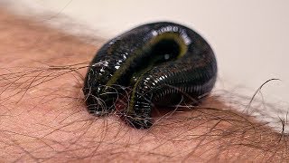 How Leeches are used in Modern Surgery  Earth Science [upl. by Healion]