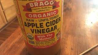 Top 20 Benefits Of Braggs Apple Cider Vinegar ACV for weight loss and good health [upl. by Seleta]