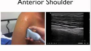 Introduction to musculoskeletal ultrasound [upl. by Player767]