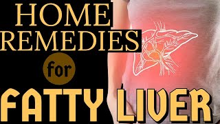 Home Remedies For Fatty Liver  By Dr Willie Ong Internist amp Cardiologist [upl. by Hacker]